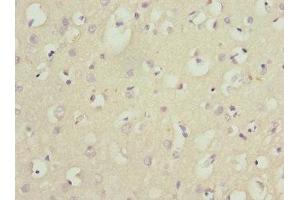 Immunohistochemistry of paraffin-embedded human brain tissue using ABIN7165131 at dilution of 1:100