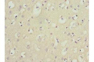 Immunohistochemistry of paraffin-embedded human brain tissue using ABIN7165131 at dilution of 1:100 (Nerve Growth Factor Receptor (TNFRSF16) Associated Protein 1 (NGFRAP1) (AA 1-111) anticorps)