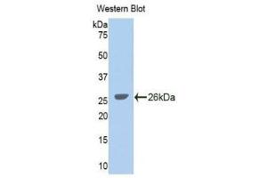 Western Blotting (WB) image for anti-Glycine Dehydrogenase (GLDC) (AA 627-833) antibody (ABIN1859022) (GLDC anticorps  (AA 627-833))