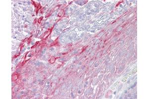 Anti-CFP / Properdin antibody IHC of human tonsil.