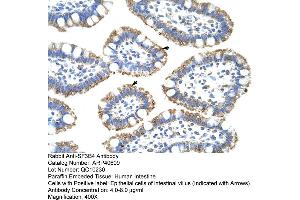 Rabbit Anti-SF3B4 Antibody  Paraffin Embedded Tissue: Human Intestine Cellular Data: Epithelial cells of intestinal villas Antibody Concentration: 4.