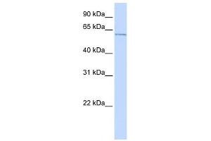 ME2 antibody used at 1 ug/ml to detect target protein. (NAD-ME anticorps)