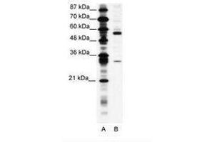 Image no. 1 for anti-Coronin, Actin Binding Protein, 1A (CORO1A) (C-Term) antibody (ABIN305990) (Coronin 1a anticorps  (C-Term))