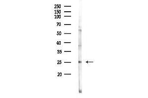 Western blot analysis of lysates from COLO205 cells(heat-shock,45 min treatment), using Phospho-HSP27 (Ser78) Antibody at 1/1000 dilution.
