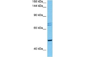 Host:  Mouse  Target Name:  PKD2  Sample Tissue:  Mouse Heart  Antibody Dilution:  1ug/ml