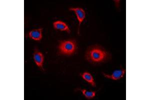 Immunofluorescent analysis of GPR119 staining in HeLa cells.