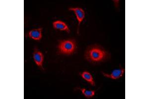 Immunofluorescent analysis of GPR119 staining in HeLa cells. (G Protein-Coupled Receptor 119 anticorps  (Center))
