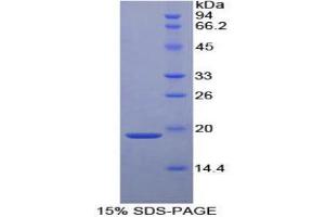 SDS-PAGE (SDS) image for Alpha2 Antiplasmin (SERPINF2) (AA 340-491) protein (His tag) (ABIN1878445) (alpha 2 Antiplasmin Protein (AA 340-491) (His tag))