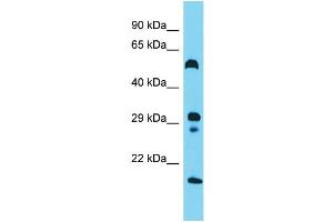 Host: Rabbit  Target Name: Hrh3  Sample Tissue: Rat Small Intestine lysates  Antibody Dilution: 1. (HRH3 anticorps  (N-Term))