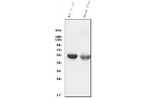 Western blot analysis of Cytochrome p450 2C19/CYP2C19 using anti-Cytochrome p450 2C19/CYP2C19 antibody (ABIN7603007).