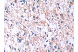 Used in DAB staining on fromalin fixed paraffin- embedded kidney tissue (IL13 Receptor alpha 1 anticorps  (AA 203-376))