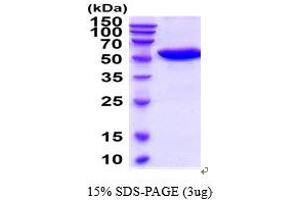 SDS-PAGE (SDS) image for Carnosine Dipeptidase 1 (Metallopeptidase M20 Family) (CNDP1) (AA 1-492) protein (His tag) (ABIN5854658)