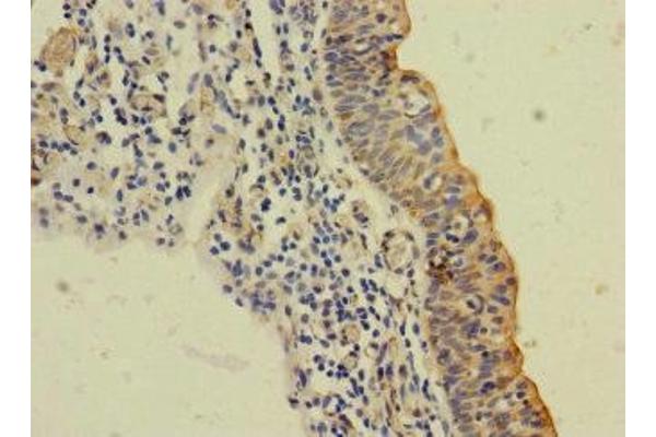 SLC6A15 anticorps  (AA 357-452)
