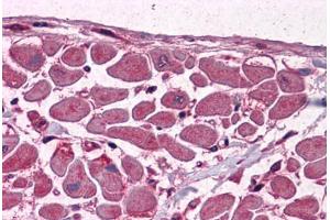 anti-Muscleblind-like Protein 1 (MBNL1) (AA 1-383) antibody