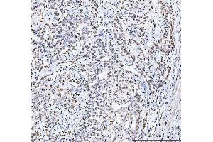 IHC analysis of MCM6 using anti-MCM6 antibody (ABIN7600038).