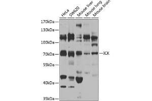 Western blot analysis of extracts of various cell lines, using ICK antibody (ABIN6130510, ABIN6142127, ABIN6142128 and ABIN6223738) at 1:1000 dilution. (ICK anticorps  (AA 1-270))