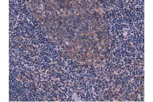 Image no. 8 for anti-COBW Domain Containing 1 (CBWD1) antibody (ABIN1497117) (CBWD1 anticorps)