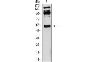 Western blot analysis using CD119 mouse mAb against HepG2 (1) cell lysate.