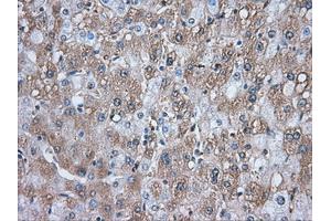 Image no. 9 for anti-Transforming, Acidic Coiled-Coil Containing Protein 3 (TACC3) antibody (ABIN1498099) (TACC3 anticorps)