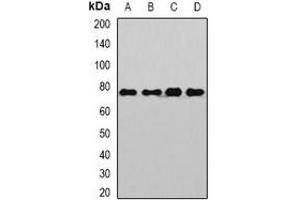 Western blot analysis of Sp110 expression in Jurkat (A), Hela (B), mouse liver (C), rat brain (D) whole cell lysates. (SP110 anticorps)