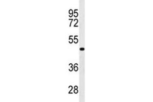 Western blot analysis of GATA6 antibody in WiDr lysate.