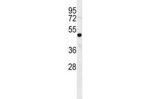 FEZF2 antibody western blot analysis in HL-60 lysate.