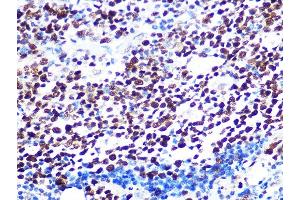 Immunohistochemistry of paraffin-embedded human appendix using K/H Rabbit mAb (ABIN7267702) at dilution of 1:100 (40x lens). (HAT1 anticorps)