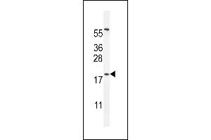 DA5 Antibody (N-term) (ABIN655277 and ABIN2844869) western blot analysis in HL-60 cell line lysates (35 μg/lane). (DPPA5 anticorps  (N-Term))