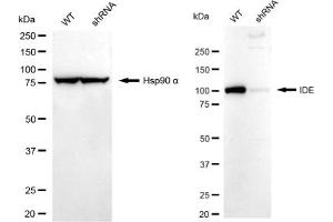 Western blotting analysis using IDE antibody (ABIN7799047). (Recombinant IDE anticorps)
