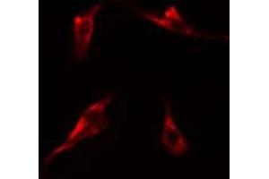 ABIN6275227 staining  Hela cells by IF/ICC. (MBTPS1 anticorps  (Internal Region))