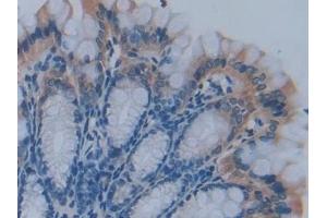 Detection of PFKP in Mouse Small intestine Tissue using Polyclonal Antibody to Phosphofructokinase, Platelet (PFKP)