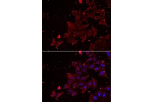 Immunofluorescence analysis of NIH/3T3 cells using MSRA Rabbit pAb (ABIN6128249, ABIN6144086, ABIN6144088 and ABIN6222015) at dilution of 1:350 (40x lens). (MSRA anticorps  (AA 24-235))