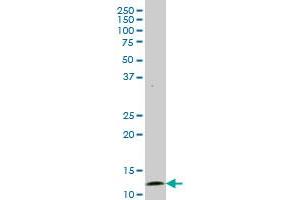 GHRL monoclonal antibody (M06), clone 4E5. (Ghrelin anticorps  (AA 1-117))