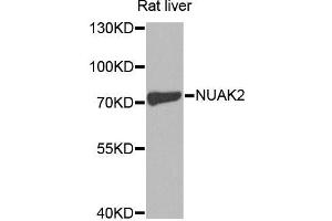 Western blot analysis of extracts of rat liver, using NUAK2 antibody (ABIN5970437) at 1/1000 dilution. (NUAK2 anticorps)