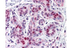 Anti-LMO4 antibody IHC of human breast. (LMO4 anticorps  (AA 1-166))