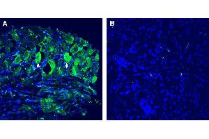Expression of TMEM150C in rat dorsal root ganglia (DRG). (TMEM150C anticorps  (Extracellular))