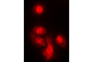 Immunofluorescent analysis of KIF4A staining in MCF7 cells. (KIF4A anticorps  (C-Term))