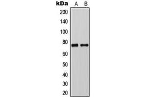 Western blot analysis of CLCNKA expression in HeLa (A), rat liver (B) whole cell lysates.