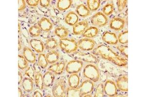 Immunohistochemistry of paraffin-embedded human kidney tissue using ABIN7151886 at dilution of 1:100 (EPS8-Like 2 anticorps  (AA 201-500))