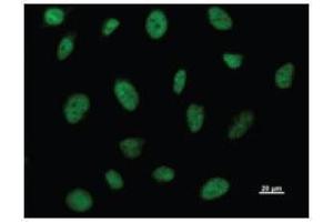 Immunostaining analysis in HeLa cells.