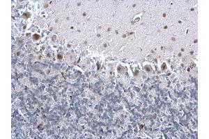 IHC-P Image PCNA antibody detects PCNA protein at nucleus on rat hind brain by immunohistochemical analysis. (PCNA anticorps)