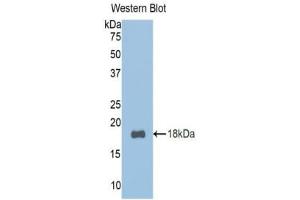 Detection of Recombinant TCF20, Mouse using Polyclonal Antibody to Transcription factor 20 (TCF20) (TCF20 anticorps  (AA 392-524))