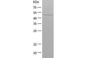 Western Blotting (WB) image for Septin 6 (SEPT6) (AA 1-434) protein (His-IF2DI Tag) (ABIN7125028)