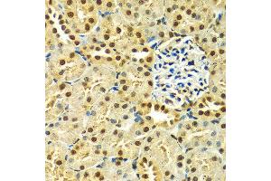 Immunohistochemistry of paraffin-embedded Rat kidney using HNRNPA2B1 antibody at dilution of 1:100 (x400 lens). (HNRNPA2B1 anticorps  (AA 1-180))