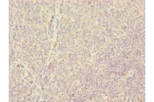 Immunohistochemistry of paraffin-embedded human tonsil tissue using ABIN7147360 at dilution of 1:100 (CENPH anticorps  (AA 1-247))