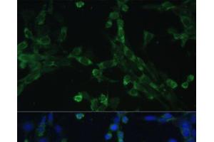 Immunofluorescence analysis of NIH-3T3 cells using EEF1G Polyclonal Antibody at dilution of 1:100 (40x lens). (EEF1G anticorps)