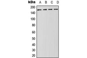 Western blot analysis of DROSHA expression in Jurkat (A), HeLa (B), NIH3T3 (C), PC12 (D) whole cell lysates. (DROSHA anticorps  (Center))