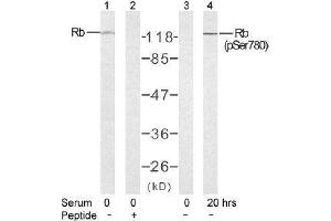 Image no. 2 for anti-Retinoblastoma 1 (RB1) (pSer780) antibody (ABIN196843) (Retinoblastoma 1 anticorps  (pSer780))