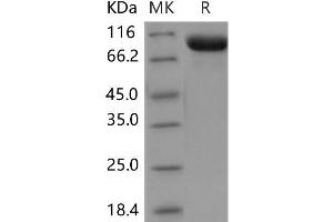 Western Blotting (WB) image for TEK Tyrosine Kinase, Endothelial (TEK) (Active) protein (His tag) (ABIN7320055) (TEK Protein (His tag))