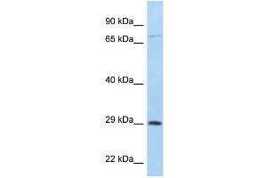 WB Suggested Anti-F11R Antibody Titration: 1. (F11R anticorps  (C-Term))